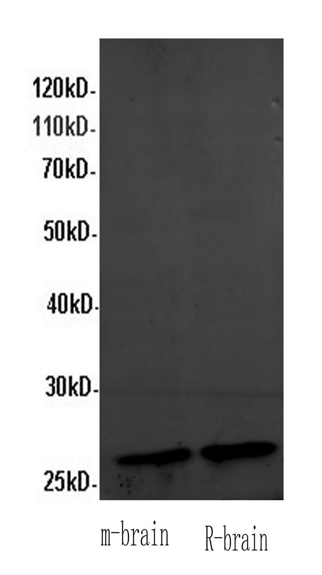 FGF12 Antibody - Western Blot analysis of Mouse brain and Rat brain using FGF12 Polyclonal Antibody at dilution of 1:600.