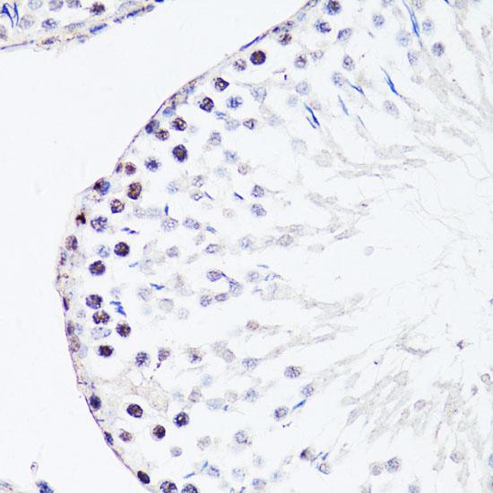 FGF12 Antibody - Immunohistochemistry of paraffin-embedded Rat testis using FGF12 Polyclonal Antibody at dilution of 1:150 (40x lens).