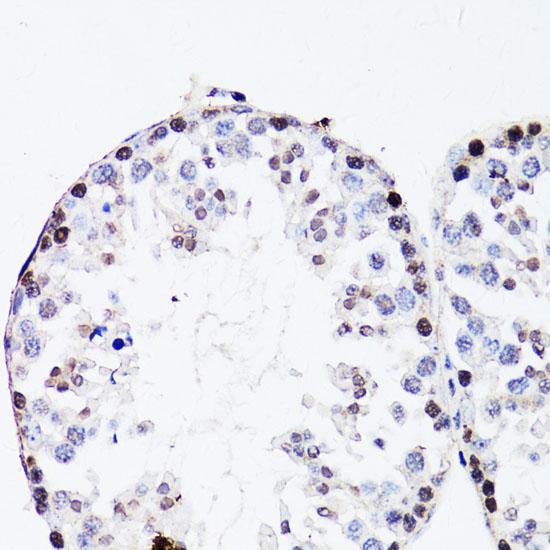 FGF12 Antibody - Immunohistochemistry of paraffin-embedded Mouse testis using FGF12 Polyclonal Antibody at dilution of 1:150 (40x lens).