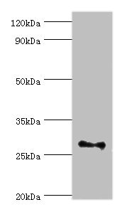 FGF13 Antibody - Western blot All lanes: Fibroblast growth factor 13 antibody at 3µg/ml + Rat brain tissue Secondary Goat polyclonal to rabbit IgG at 1/10000 dilution Predicted band size: 28, 22, 29, 23, 26 kDa Observed band size: 28 kDa