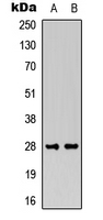 FGF13 Antibody - Western blot analysis of FGF13 expression in MCF7 (A); rat muscle (B) whole cell lysates.