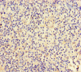 FGF13 Antibody - Immunohistochemistry of paraffin-embedded human appendix tissue using FGF13 Antibody at dilution of 1:100