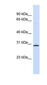 FGF14 Antibody - FGF14 antibody Western blot of Fetal Lung lysate. This image was taken for the unconjugated form of this product. Other forms have not been tested.