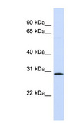 FGF14 Antibody - FGF14 antibody Western blot of Fetal Lung lysate. This image was taken for the unconjugated form of this product. Other forms have not been tested.