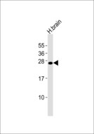 FGF14 Antibody - Anti-FGF14 Antibody at 1:4000 dilution + human brain lysates Lysates/proteins at 20 ug per lane. Secondary Goat Anti-Rabbit IgG, (H+L), Peroxidase conjugated at 1/10000 dilution Predicted band size : 28 kDa Blocking/Dilution buffer: 5% NFDM/TBST.