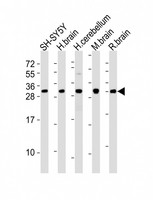 FGF14 Antibody - All lanes : Anti-FGF14 Antibody at 1:2000 dilution Lane 1: SH-SY5Y whole cell lysates Lane 2: human brain lysates Lane 3: human cerebellum lysates Lane 4: mouse brain lysates Lane 5: rat brain lysates Lysates/proteins at 20 ug per lane. Secondary Goat Anti-Rabbit IgG, (H+L), Peroxidase conjugated at 1/10000 dilution Predicted band size : 28 kDa Blocking/Dilution buffer: 5% NFDM/TBST.