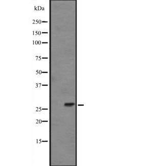 FGF14 Antibody - Western blot analysis of FGF14 expression in mouse brain lysate (in RIPA buffer). The lane on the left is treated with the antigen-specific peptide.