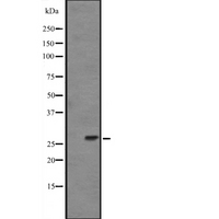 FGF14 Antibody - Western blot analysis of FGF14 expression in mouse brain lysate (in RIPA buffer). The lane on the left is treated with the antigen-specific peptide.