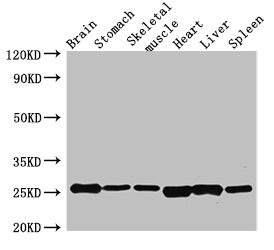 Fgf15 Antibody - Western Blot Positive WB detected in:Mouse brain tissue,Mouse stomach tissue,Mouse skeletal muscle tissue,Rat heart tissue,Rat liver tissue,Rat spleen tissue All Lanes:Fgf15 antibody at 3.5µg/ml Secondary Goat polyclonal to rabbit IgG at 1/50000 dilution Predicted band size: 26 KDa Observed band size: 26 KDa