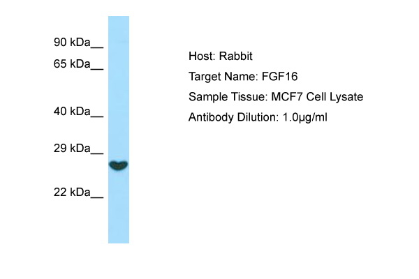 FGF16 Antibody -  This image was taken for the unconjugated form of this product. Other forms have not been tested.