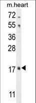 FGF16 Antibody - FGF16 Antibody western blot of mouse heart tissue lysates (35 ug/lane). The FGF16 antibody detected the FGF16 protein (arrow).