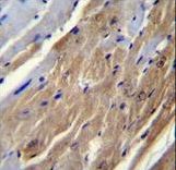 FGF16 Antibody - FGF16 Antibody immunohistochemistry of formalin-fixed and paraffin-embedded mouse heart tissue followed by peroxidase-conjugated secondary antibody and DAB staining.