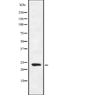 FGF16 Antibody - Western blot analysis FGF16 using HeLa whole cells lysates