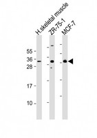 FGF17 Antibody - All lanes: Anti-FGF17 Antibody (N-Term) at 1:2000 dilution. Lane 1: human skeletal muscle lysates. Lane 2: ZR-75-1 whole cell lysates. Lane 3: MCF-7 whole cell lysates Lysates/proteins at 20 ug per lane. Secondary Goat Anti-Rabbit IgG, (H+L), Peroxidase conjugated at 1:10000 dilution. Predicted band size: 25 kDa. Blocking/Dilution buffer: 5% NFDM/TBST.
