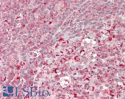 FGF17 Antibody - Human Tonsil: Formalin-Fixed, Paraffin-Embedded (FFPE)