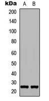 FGF17 Antibody - Western blot analysis of FGF17 expression in NS-1 (A); PC12 (B) whole cell lysates.