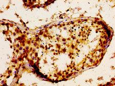 FGF17 Antibody - Immunohistochemistry image of paraffin-embedded human testis tissue at a dilution of 1:100
