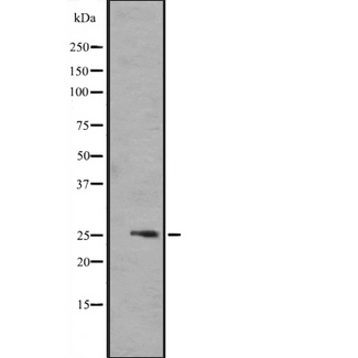 FGF17 Antibody - Western blot analysis of FGF17 expression in 721_B cells lysate. The lane on the left is treated with the antigen-specific peptide.