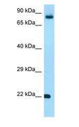 FGF18 Antibody - FGF18 antibody Western Blot of ACHN.  This image was taken for the unconjugated form of this product. Other forms have not been tested.