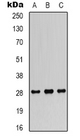 FGF18 Antibody - Western blot analysis of FGF18 expression in SW480 (A); SKOV3 (B); mouse heart (C) whole cell lysates.