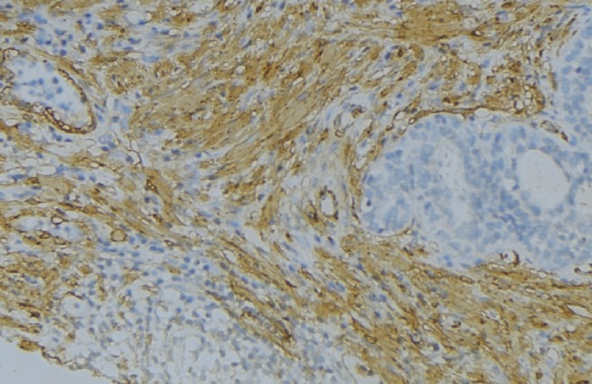 FGF18 Antibody - 1:100 staining human uterus tissue by IHC-P. The sample was formaldehyde fixed and a heat mediated antigen retrieval step in citrate buffer was performed. The sample was then blocked and incubated with the antibody for 1.5 hours at 22°C. An HRP conjugated goat anti-rabbit antibody was used as the secondary.