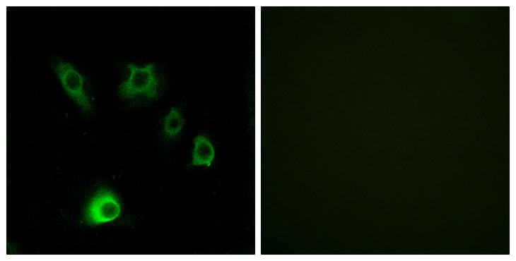 FGF18 Antibody - Peptide - + Immunofluorescence analysis of HuvEc cells, using FGF18 antibody.