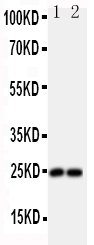 FGF19 Antibody - Anti-FGF19 antibody, Western blotting All lanes: Anti FGF19 at 0.5ug/ml Lane 1: U87 Whole Cell Lysate at 40ugLane 2: SMMC Whole Cell Lysate at 40ugPredicted bind size: 24KD Observed bind size: 24KD