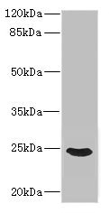 FGF19 Antibody - Western blot All Lanes: FGF19 antibody IgG at 3.26ug/ml+ Mouse brain tissue Secondary Goat polyclonal to rabbit IgG at 1/10000 dilution Predicted band size: 24 kDa Observed band size: 24 kDa