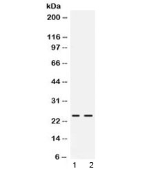 FGF19 Antibody - Western blot testing of rat 1) pancreas and 2) NRK lysate with FGF19 antibody at 0.5ug/ml. Predicted/observed molecular weight: ~24 kDa.