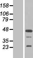 FGF19 Protein - Western validation with an anti-DDK antibody * L: Control HEK293 lysate R: Over-expression lysate