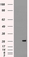 FGF2 / Basic FGF Antibody - HEK293T cells were transfected with the pCMV6-ENTRY control (Left lane) or pCMV6-ENTRY BFGF (Right lane) cDNA for 48 hrs and lysed. Equivalent amounts of cell lysates (5 ug per lane) were separated by SDS-PAGE and immunoblotted with anti-BFGF.