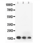 FGF2 / Basic FGF Antibody - anti-FGF2 antibody, Western blotting All lanes: Anti FGF2 at 0.5ug/ml Lane 1: Recombinant Human FGF2 Protein 10ng Lane 2: Recombinant Human FGF2 Protein 5ng Lane 3: Recombinant Human FGF2 Protein 2. 5ng Predicted bind size: 17KD Observed bind size: 17KD