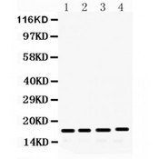 FGF2 / Basic FGF Antibody - FGF2 antibody Western blot. All lanes: Anti FGF2 at 0.5 ug/ml. Lane 1: Human Placenta Tissue Lysate at 50 ug. Lane 2: Rat Brain Tissue Lysate at 50 ug. Lane 3: Rat Kidney Tissue Lysate at 50 ug. Lane 4: Rat Spleen Tissue Lysate at 50 ug. Predicted band size: 17 kD. Observed band size: 17 kD.