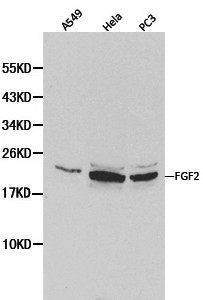 FGF2 / Basic FGF Antibody - Western blot of Basic FGF(FGF2) pAb in extracts from A549, Hela and PC3 cells.