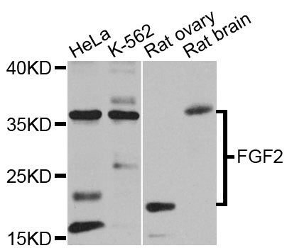 FGF2 / Basic FGF Antibody - Western blot analysis of extracts of various cell lines, using FGF2 antibody at 1:1000 dilution. The secondary antibody used was an HRP Goat Anti-Rabbit IgG (H+L) at 1:10000 dilution. Lysates were loaded 25ug per lane and 3% nonfat dry milk in TBST was used for blocking. An ECL Kit was used for detection and the exposure time was 30s.
