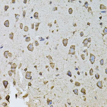 FGF2 / Basic FGF Antibody - Immunohistochemistry of paraffin-embedded mouse brain using FGF2 antibodyat dilution of 1:100 (40x lens).
