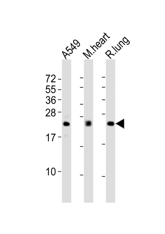 FGF2 / Basic FGF Antibody - All lanes : Anti-FGF2 Antibody at 1:2000 dilution Lane 1: A549 whole cell lysates Lane 2: mouse heart lysates Lane 3: rat lung lysates Lysates/proteins at 20 ug per lane. Secondary Goat Anti-Rabbit IgG, (H+L), Peroxidase conjugated at 1/10000 dilution Predicted band size : 31 kDa Blocking/Dilution buffer: 5% NFDM/TBST.