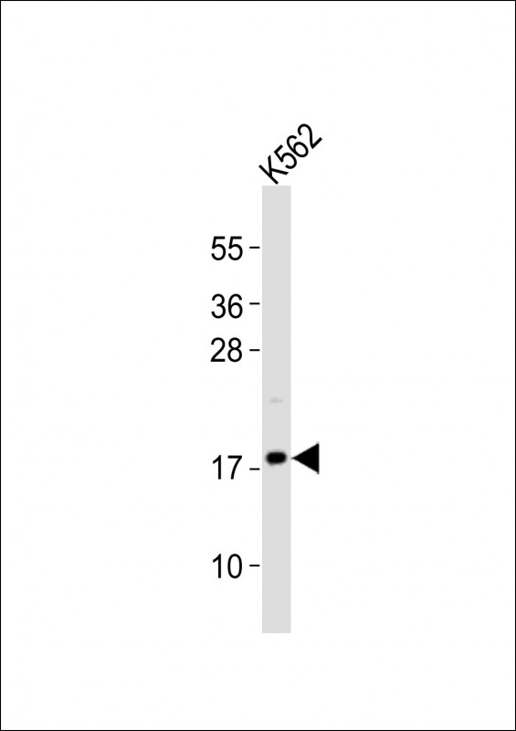 FGF2 / Basic FGF Antibody - Anti-FGF2 Antibody at 1:2000 dilution + K562 whole cell lysates Lysates/proteins at 20 ug per lane. Secondary Goat Anti-Rabbit IgG, (H+L), Peroxidase conjugated at 1/10000 dilution Predicted band size : 31 kDa Blocking/Dilution buffer: 5% NFDM/TBST.