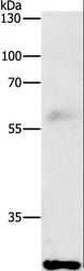 FGF2 / Basic FGF Antibody - Western blot analysis of Mouse lung tissue, using FGF2 Polyclonal Antibody at dilution of 1:1000.