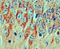FGF20 Antibody - IHC of FGF20 in formalin-fixed, paraffin-embedded mouse brain tissue using Peptide-affinity Purified Polyclonal Antibody to FGF20 at 5 ug/ml.