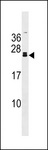 FGF20 Antibody - FGF20 Antibody western blot of mouse kidney tissue lysates (35 ug/lane). The FGF20 antibody detected the FGF20 protein (arrow).