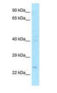 FGF20 Antibody - FGF20 antibody Western Blot of Fetal Brain.  This image was taken for the unconjugated form of this product. Other forms have not been tested.