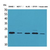FGF20 Antibody - Western blot of FGF-20 antibody
