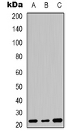 FGF20 Antibody - Western blot analysis of FGF20 expression in MCF7 (A); HL60 (B); mouse colon (C) whole cell lysates.