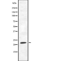 FGF20 Antibody - Western blot analysis FGF20 using RAW264.7 whole cells lysates