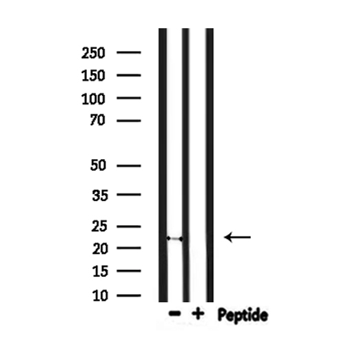 FGF20 Antibody - Western blot analysis of extracts of mouse brain tissue using FGF20 antibody.