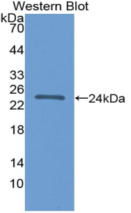 FGF21 Antibody - Western blot of recombinant FGF21.