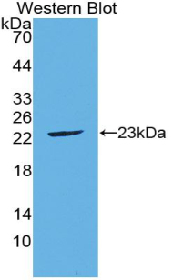 FGF21 Antibody - Western blot of recombinant FGF21.