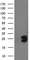 FGF21 Antibody - HEK293T cells were transfected with the pCMV6-ENTRY control (Left lane) or pCMV6-ENTRY FGF21 (Right lane) cDNA for 48 hrs and lysed. Equivalent amounts of cell lysates (5 ug per lane) were separated by SDS-PAGE and immunoblotted with anti-FGF21.
