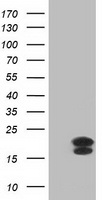 FGF21 Antibody - HEK293T cells were transfected with the pCMV6-ENTRY control (Left lane) or pCMV6-ENTRY FGF21 (Right lane) cDNA for 48 hrs and lysed. Equivalent amounts of cell lysates (5 ug per lane) were separated by SDS-PAGE and immunoblotted with anti-FGF21.